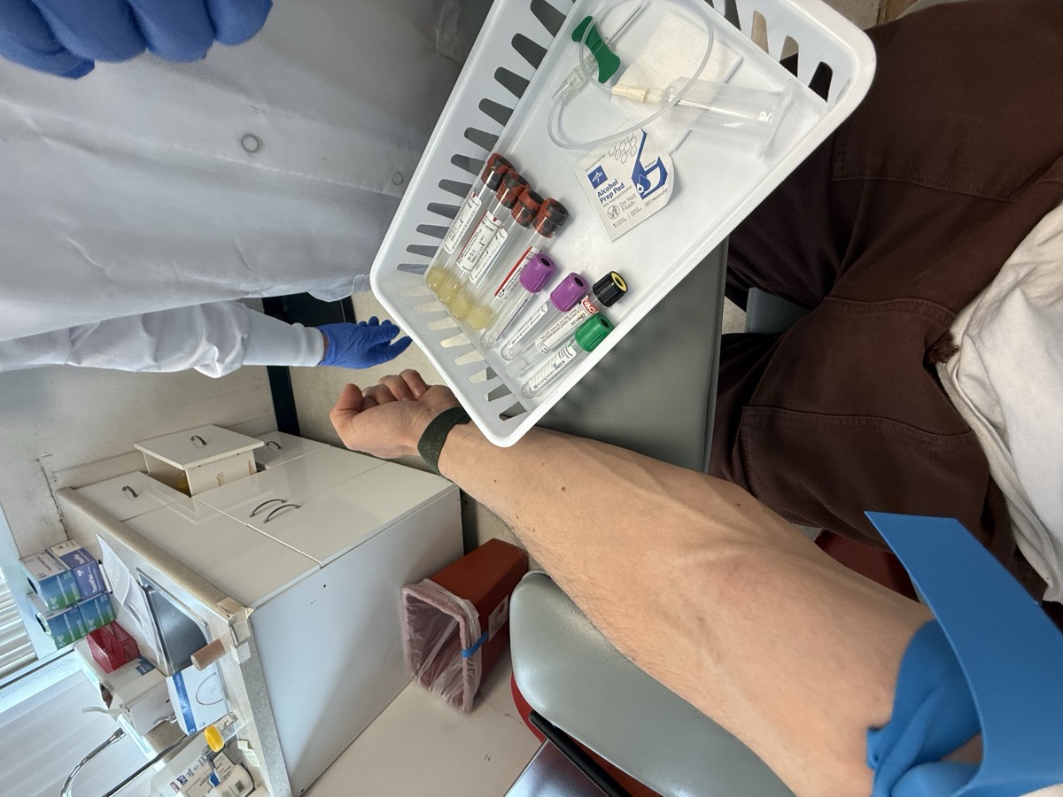 Blood draw